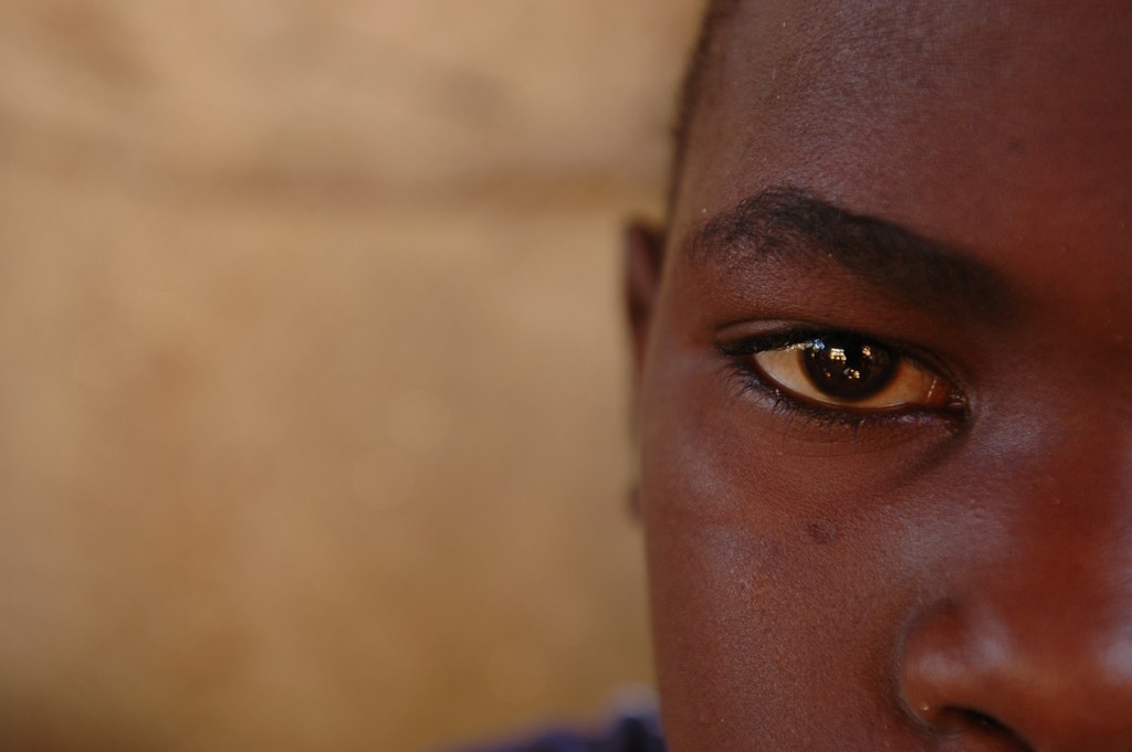 A 14-year-old boy from Jabel Marra in Darfur, who lost his mother in a brutal attack by Janjaweed militia on his village. (2004 photo)